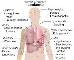 gejala leukimia