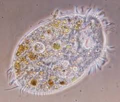 Ciri-ciri Umum Filum Protozoa